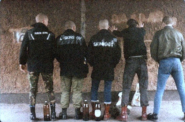 dublinskinscircaeighties